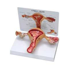 인체 교육 여성생식기 자궁 모형 G348